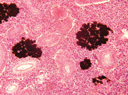 Garra congoensis